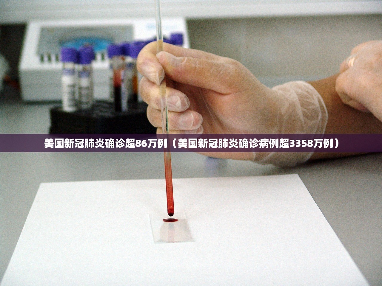 美国新冠肺炎确诊超86万例（美国新冠肺炎确诊病例超3358万例）