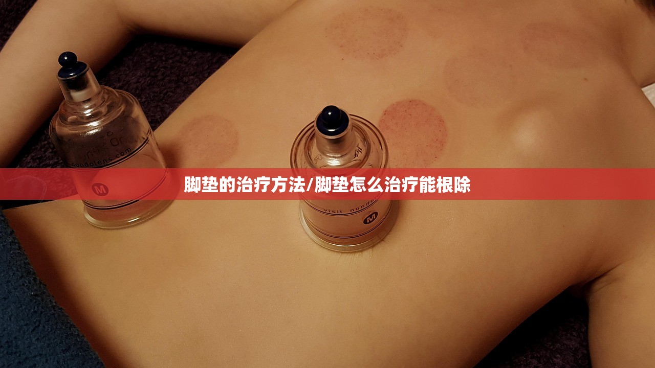 脚垫的治疗方法/脚垫怎么治疗能根除