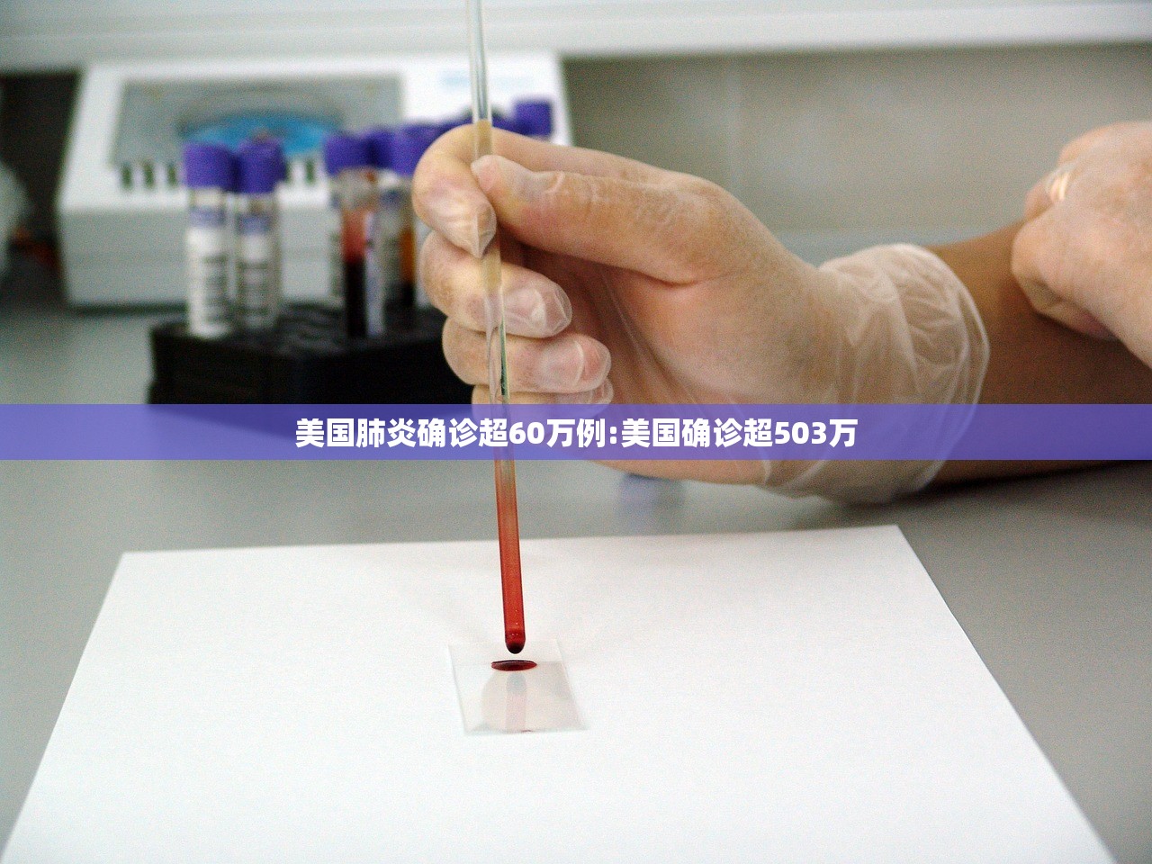 美国肺炎确诊超60万例:美国确诊超503万