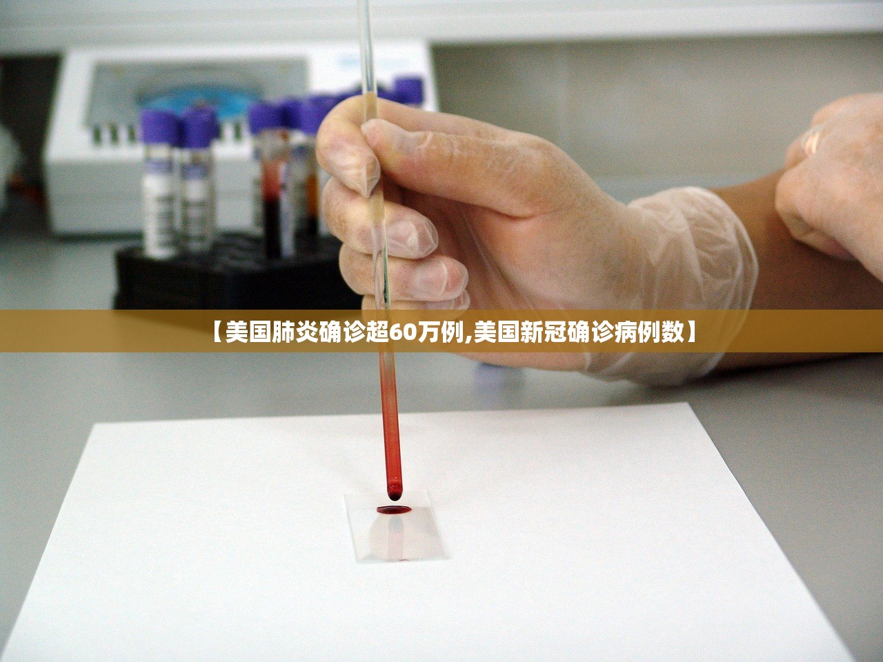 【美国肺炎确诊超60万例,美国新冠确诊病例数】