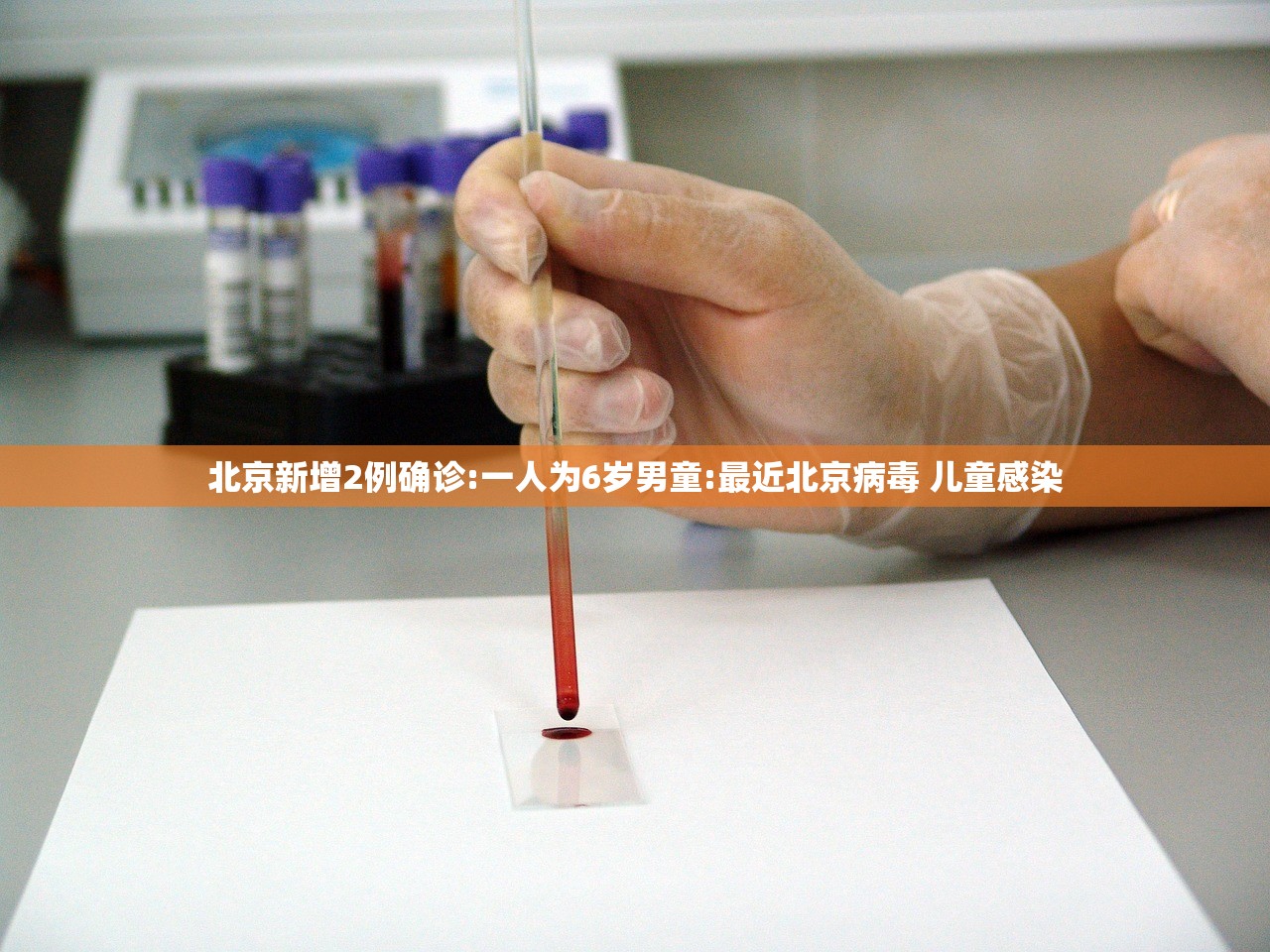 北京新增2例确诊:一人为6岁男童:最近北京病毒 儿童感染